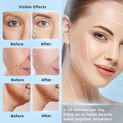 Face & Neck Lifting Device